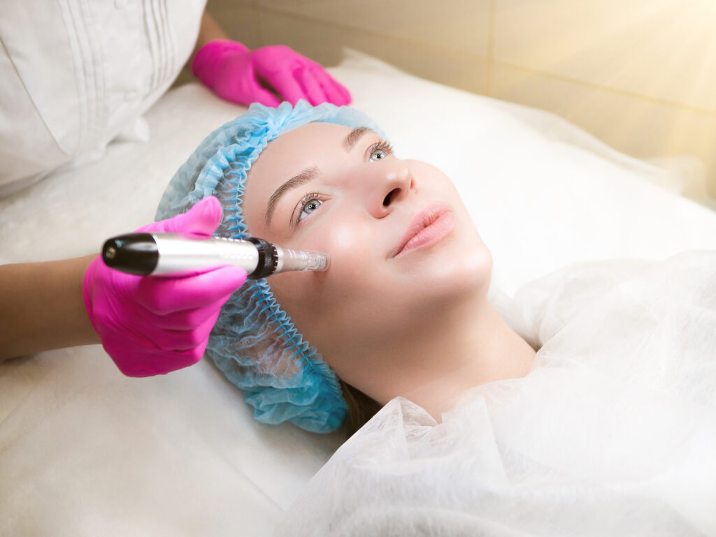 Micro needling therapy. Professional cosmetologist is doing procedure of microneedling. Fractional Needle mesotherapy with dermapen close up. Beauty salon, cosmetology clinic. Face Skin Care treatment