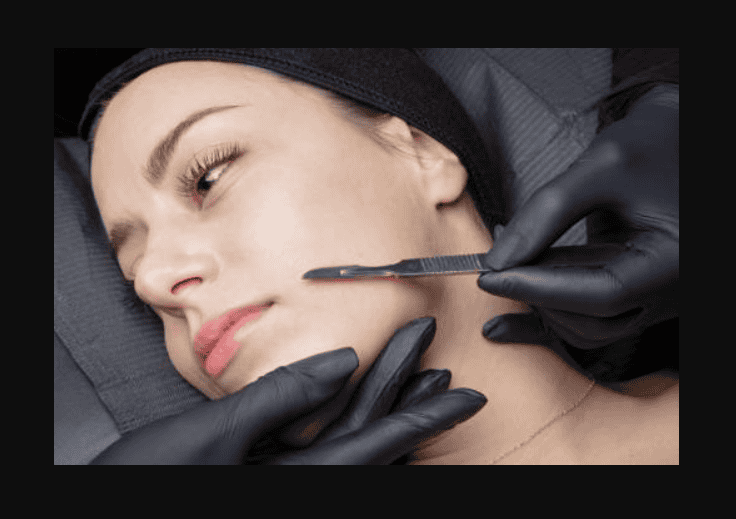 dermaplaning