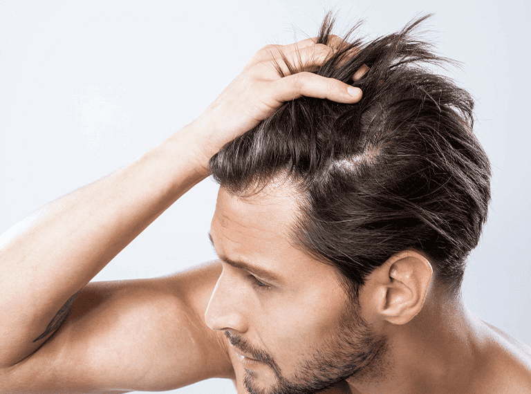 prp hair restoration